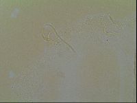 Novechiniscus armadilloides image