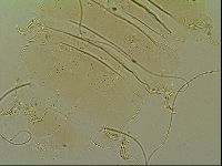 Novechiniscus armadilloides image