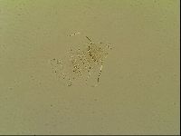 Novechiniscus armadilloides image