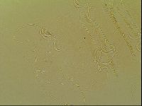 Novechiniscus armadilloides image