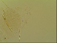 Novechiniscus armadilloides image