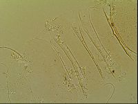 Novechiniscus armadilloides image