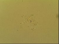 Novechiniscus armadilloides image