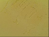 Novechiniscus armadilloides image