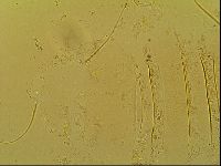 Novechiniscus armadilloides image