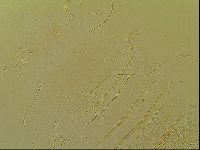 Novechiniscus armadilloides image