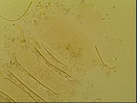 Novechiniscus armadilloides image