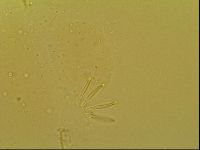 Novechiniscus armadilloides image