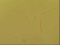 Novechiniscus armadilloides image