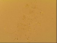 Novechiniscus armadilloides image