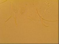 Novechiniscus armadilloides image