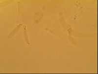Novechiniscus armadilloides image