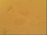 Novechiniscus armadilloides image