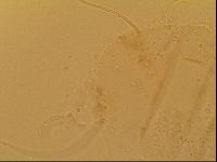 Novechiniscus armadilloides image