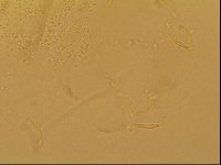 Novechiniscus armadilloides image
