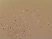 Novechiniscus armadilloides image