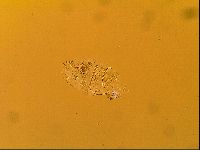 Novechiniscus armadilloides image
