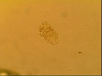 Novechiniscus armadilloides image