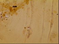Novechiniscus armadilloides image