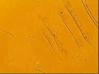 Novechiniscus armadilloides image