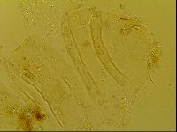 Novechiniscus armadilloides image