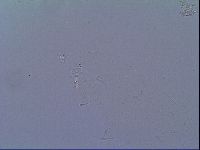 Minibiotus intermedius image