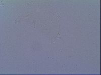 Minibiotus intermedius image