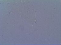 Minibiotus intermedius image