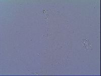 Minibiotus intermedius image