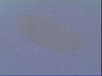 Minibiotus intermedius image