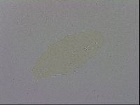 Minibiotus intermedius image