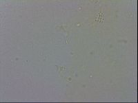 Minibiotus intermedius image