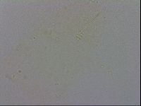 Minibiotus intermedius image
