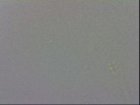Minibiotus intermedius image