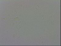 Minibiotus intermedius image