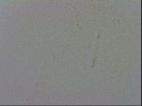 Minibiotus intermedius image