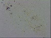 Minibiotus intermedius image