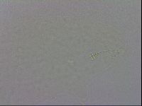 Minibiotus intermedius image