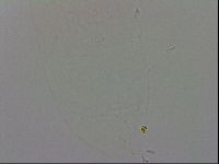 Minibiotus intermedius image