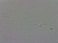 Minibiotus intermedius image