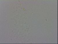 Minibiotus intermedius image