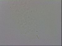 Minibiotus intermedius image
