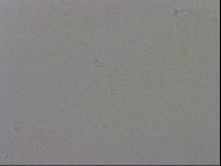 Minibiotus intermedius image