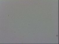 Minibiotus intermedius image