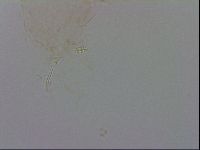 Minibiotus intermedius image