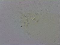 Minibiotus intermedius image