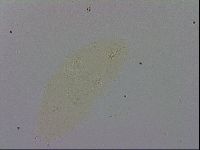 Minibiotus intermedius image