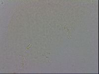 Minibiotus intermedius image