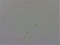 Minibiotus intermedius image