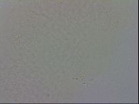 Minibiotus intermedius image